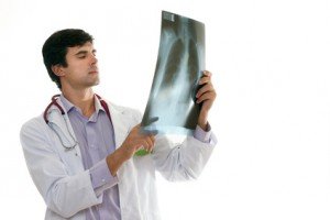 doctor with chest x-ray